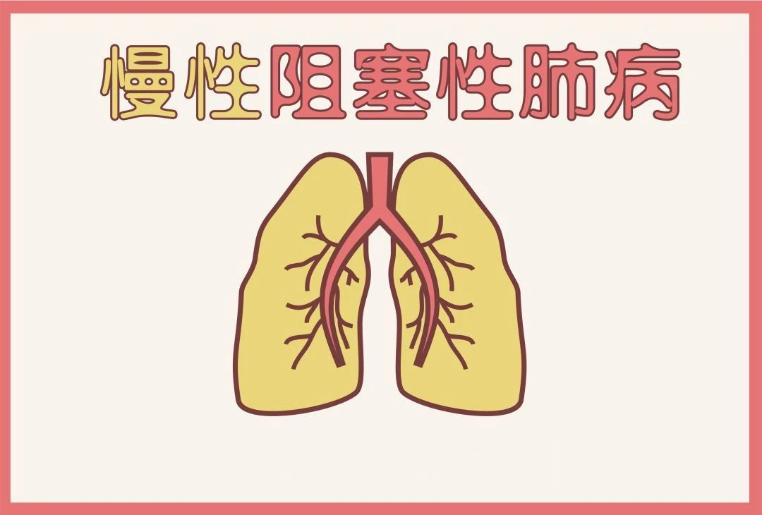 世界慢阻肺日 | 肺系生命，刻不容缓