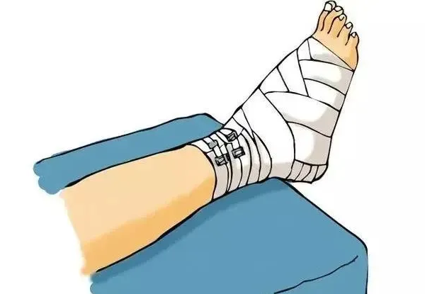 骨折了,骨头接上就行了? 骨折了,骨头接上就行了?