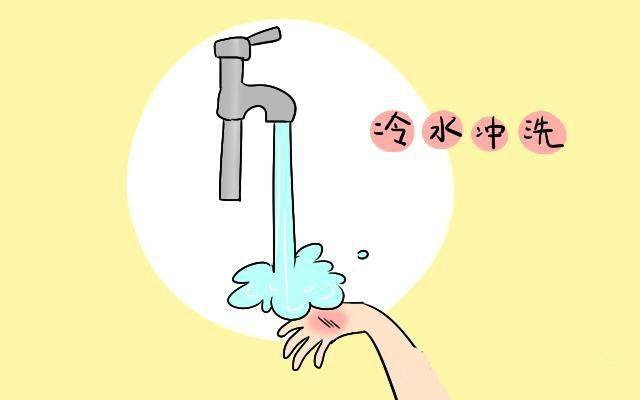 烫伤如何急救,牢记五个字! 烫伤如何急救,牢记五个字!
