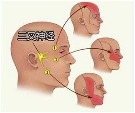 【湖北日报】三叉神经痛折磨20余年，微血管减压术成功止痛