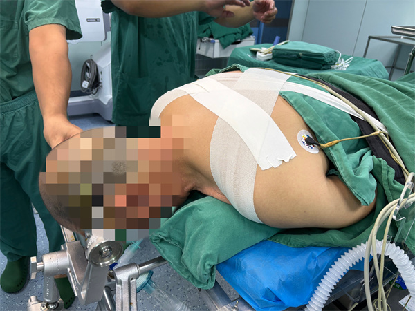【荆楚网】男子腰背疼痛一个月 脊柱竟藏有“不定时炸弹”