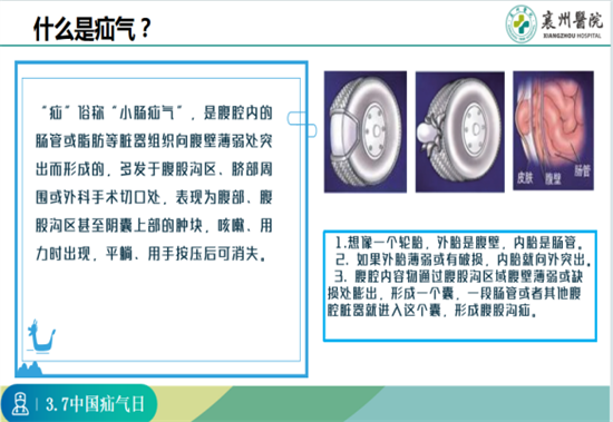 图片 3.png