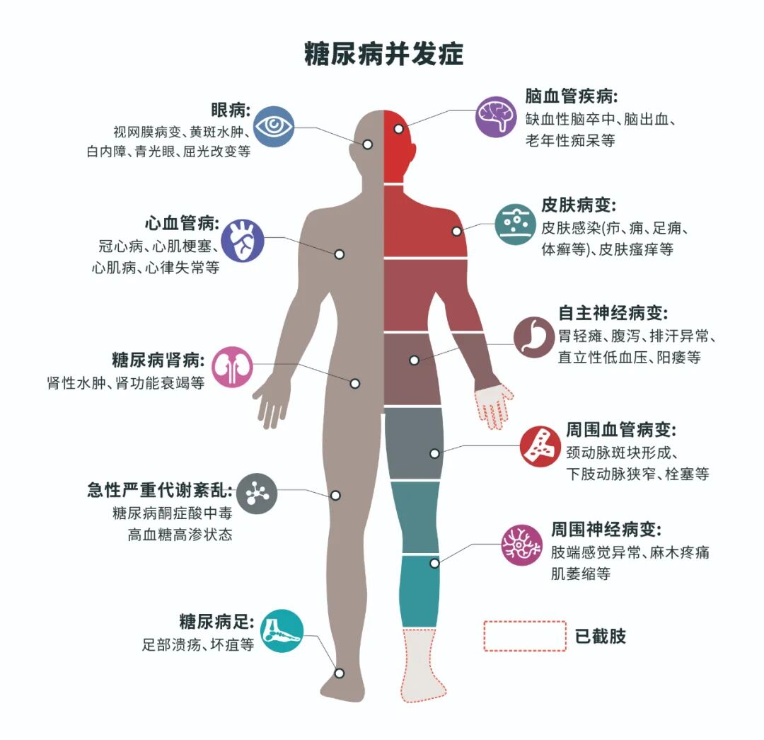 总觉得饿、视力变差……超一半糖尿病患者,不知道自己得了病 总觉得饿、视力变差……超一半糖尿病患者,不知道自己得了病